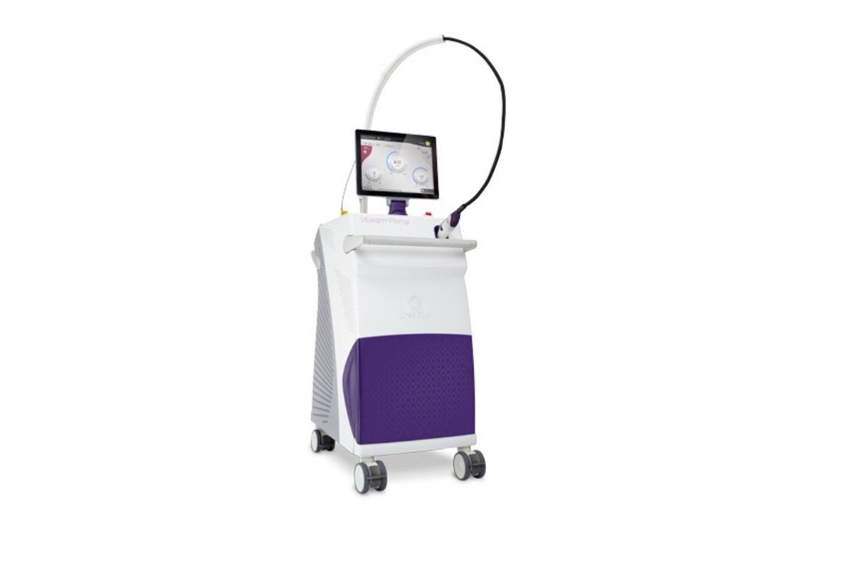 Candela VBeam lézer - Alfa-Med Lézerklinika